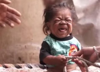 Manpreet Singh: el extraño caso del joven de 23 años atrapado en el cuerpo de un bebé