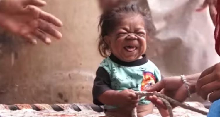 Manpreet Singh: el extraño caso del joven de 23 años atrapado en el cuerpo de un bebé