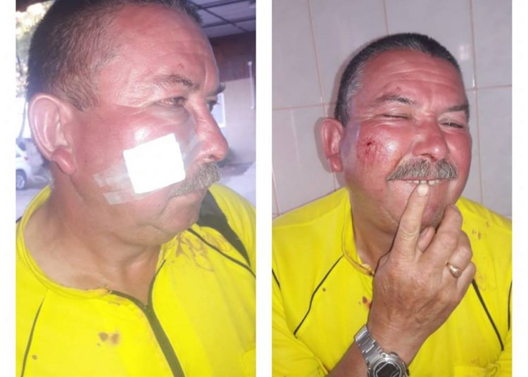 Árbitro quirihuano sufrió brutal agresión en estadio municipal de Ninhue