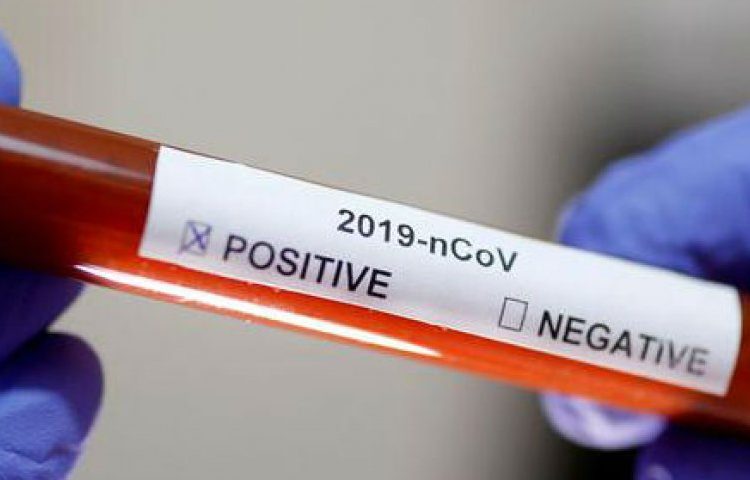 Quirihue sumó hoy un nuevo caso de coronavirus: Van 5 en la comuna