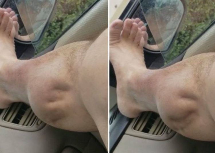 ¿Por qué ocurren los calambres?: conoce cómo aliviar sus síntomas y si es posible prevenirlos